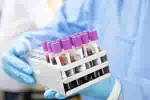 adenovirus