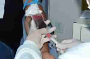 hemoal
