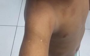preso